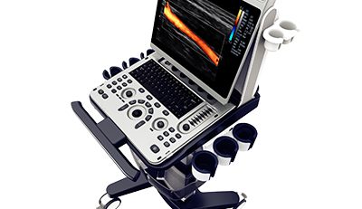 chison ebit 50 ultrasound