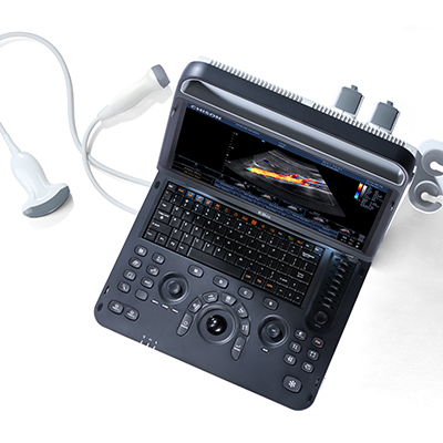 Chison EBit 60 Portable Ultrasound - Med-Tech & Design Associates ...