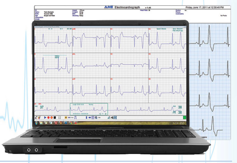 MDA ECG - Med-Tech & Design Associates International